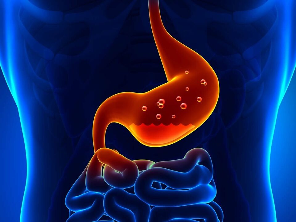 Gastritis is an inflammatory disease of the stomach that requires dietary